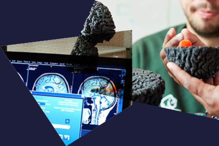 We are improving patient care and recovery after Acquired Brain Injury
